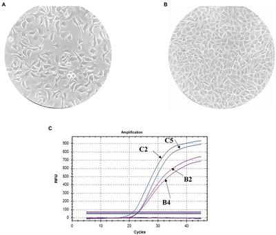 Listeria monocytogenes Invasion Into Sheep Kidney Epithelial Cells Depends on InlB, and Invasion Efficiency Is Modulated by Phylogenetically Defined InlB Isoforms